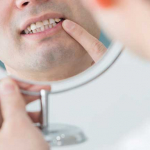 虫歯や歯周病が原因に？！歯をボロボロにする５つの悪習慣