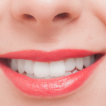 歯を白くするために知っておきたいコト・歯の黄ばみになる食べ物ってなに？